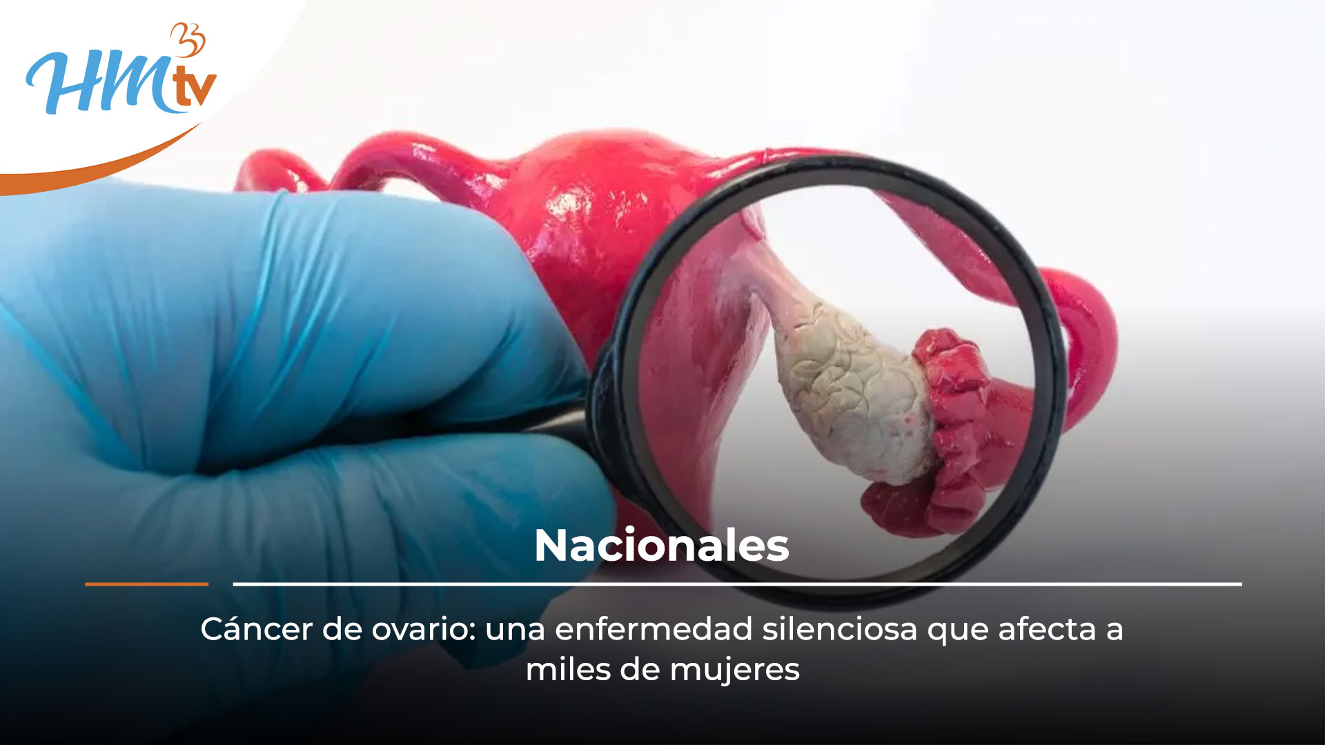 Cáncer de ovario: una enfermedad silenciosa que afecta a miles de mujeres